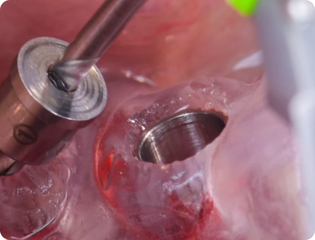 chirurgie-guidee-formation-paris-6