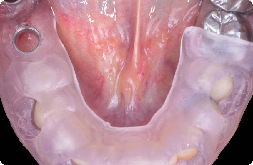 implant-dentaire-chirurgie-formation-paris-6